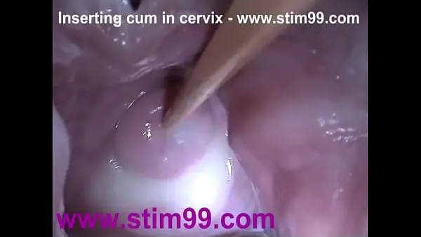 Big Insertion Semen Cum in Cervix Wide Stretching Pussy Speculum new Movies